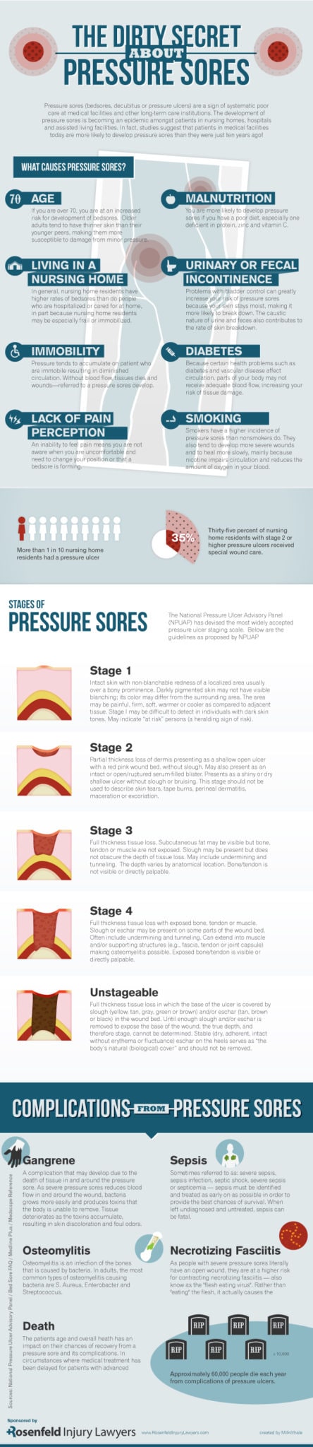 Pressure Sore Infographic