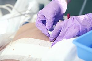 wound-care-bed-sore-nursing-home