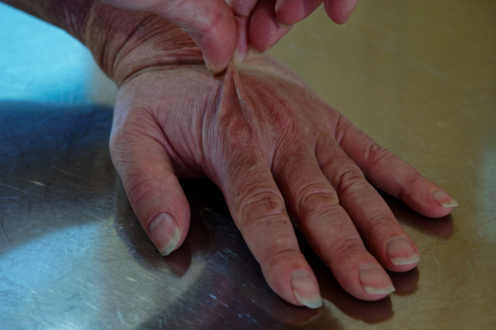 Nursing home abuse lawyer addressing dehydration-related sepsis in nursing homes, helping families seek compensation for harm caused by inadequate care and neglect.