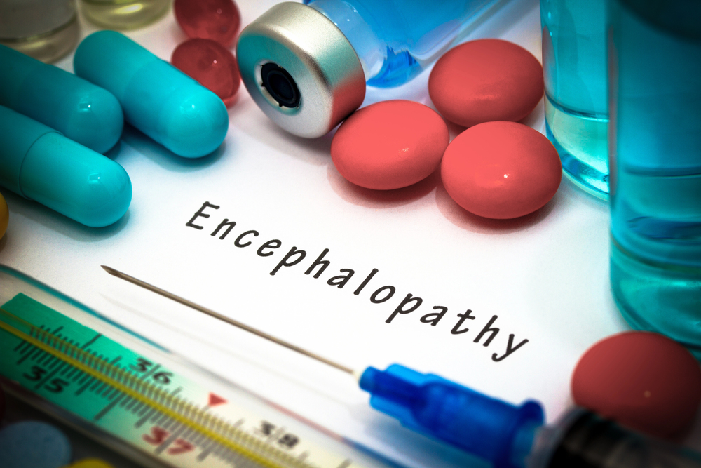 Nursing home abuse lawyer explaining the legal implications of encephalopathy caused by urinary tract infections in elderly residents and how to hold nursing facilities accountable for negligence.
