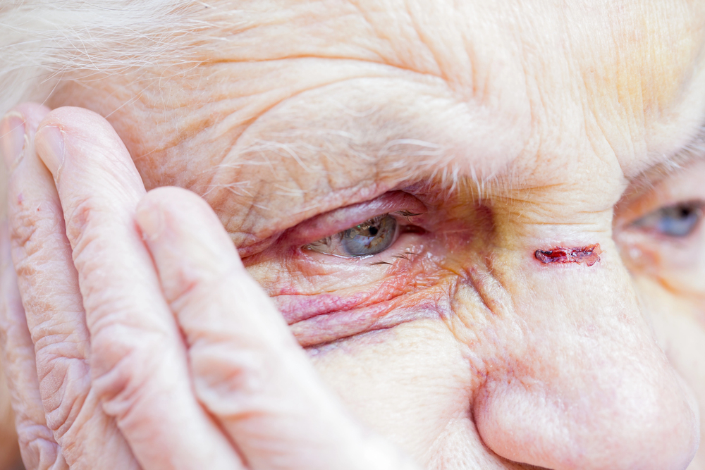 Check nursing home violations and inspections to ensure your loved one's safety—consult a skilled nursing home abuse attorney for expert legal help.