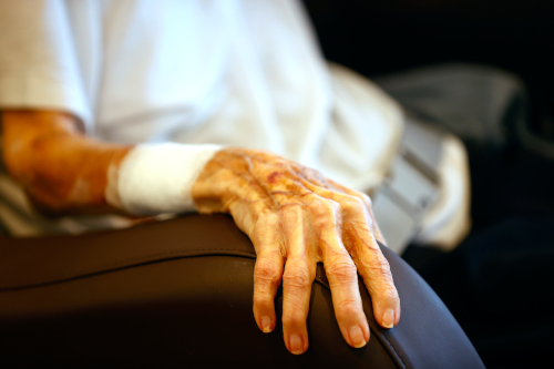 Nursing home abuse injuries