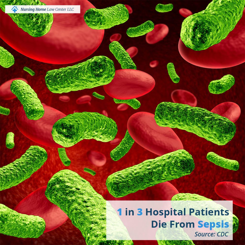 Sepsis affecting elderly nursing home residents due to neglect