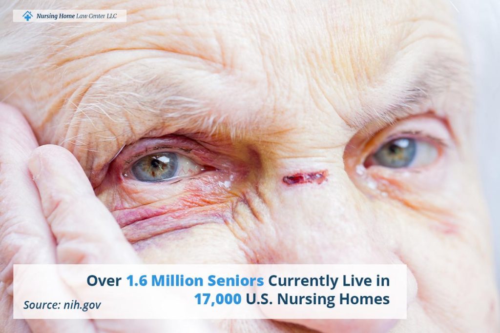 Common signs of nursing home abuse including bruises and unexplained injuries
