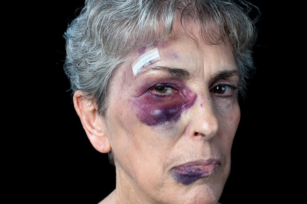 Chicago Elder Abuse Lawyer