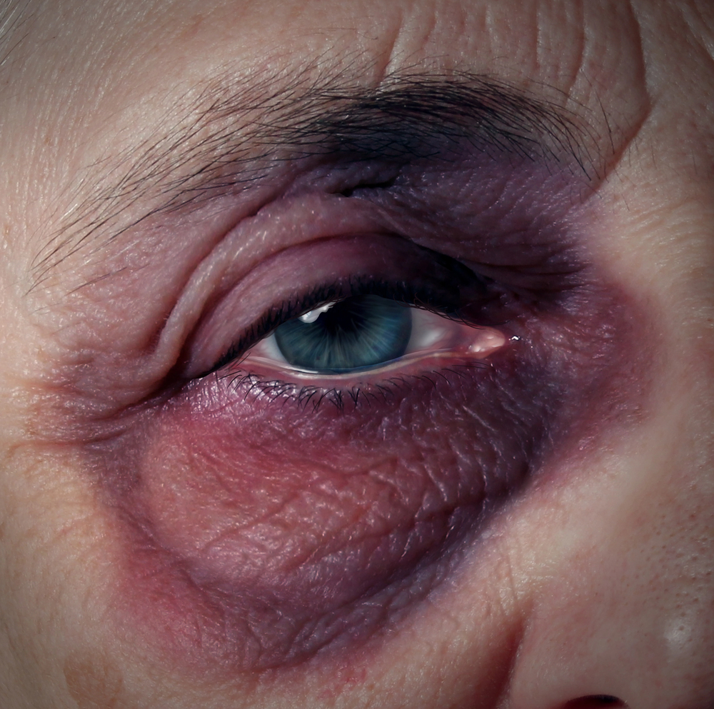 Reporting nursing home neglect to the appropriate authorities in Illinois