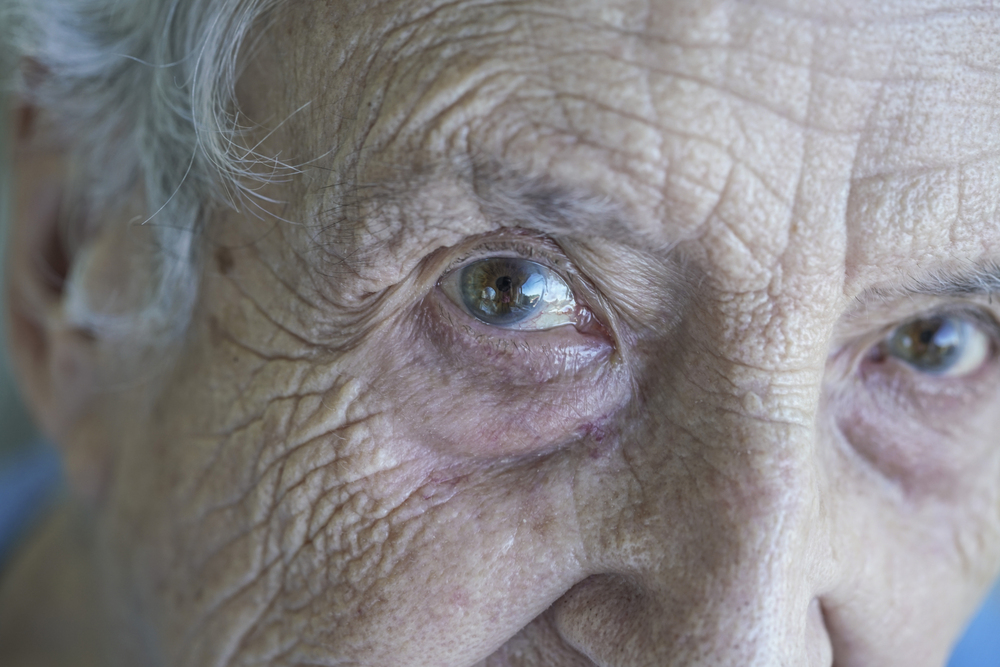 Bloomington lawyer helping a family file a nursing home neglect claim