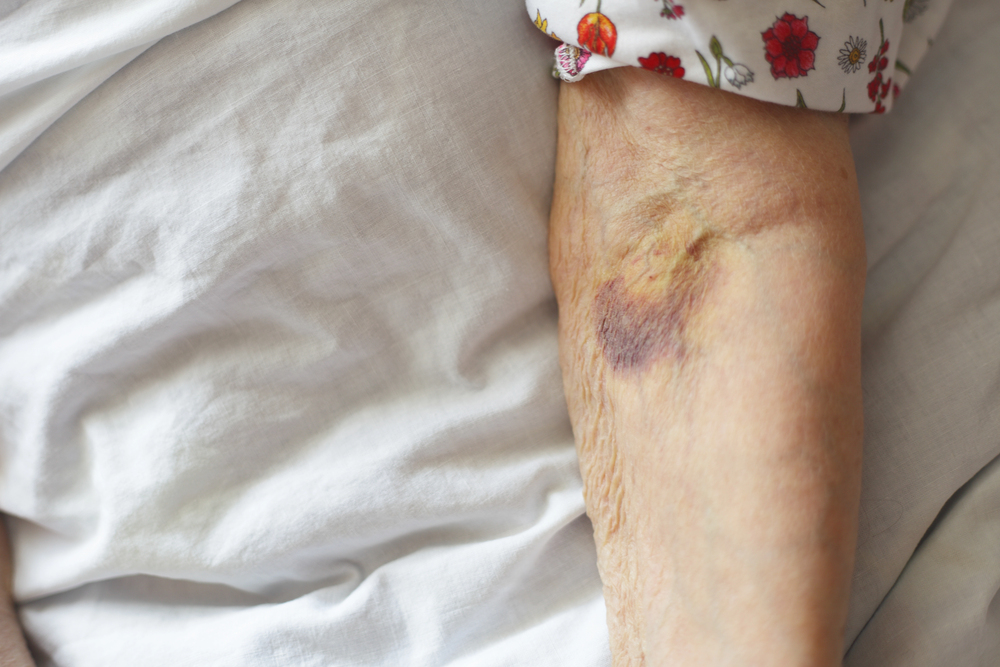 Naperville attorney handling nursing home injury and elder abuse claims