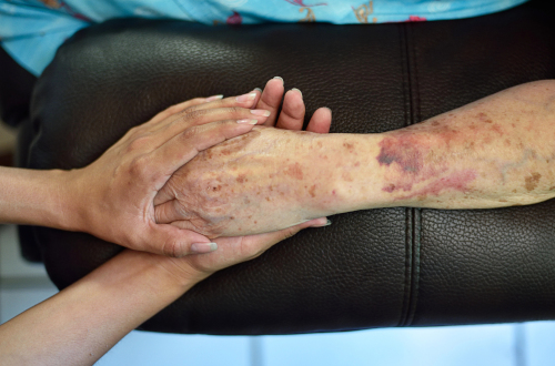 Medical records showing immobile patients left unattended