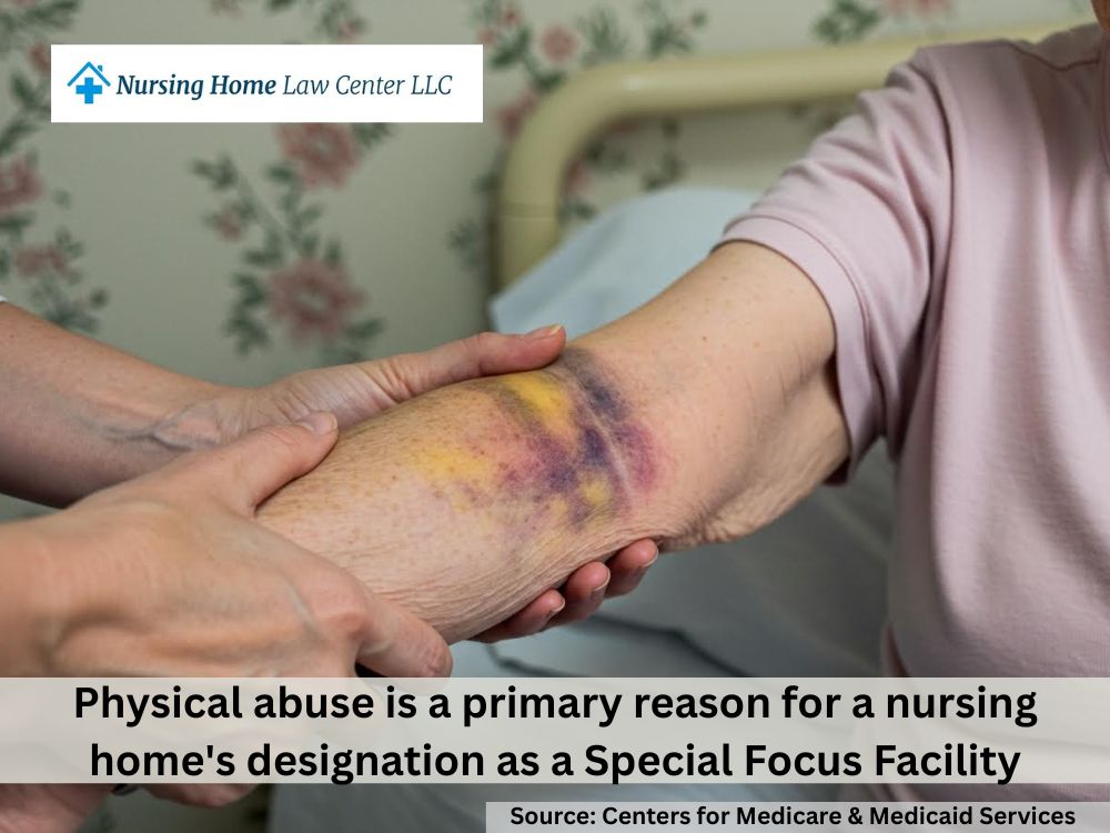 File claims for broken bones and other injuries